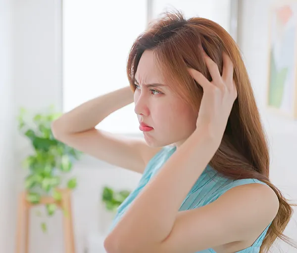 Dandruff Signs