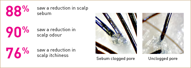 88% saw a reduction in scalp sebum and oiliness | 90% saw a reduction in scalp odour | 76% saw a reduction in scalp itchiness | Sebum clogged pore | Unclogged pore
